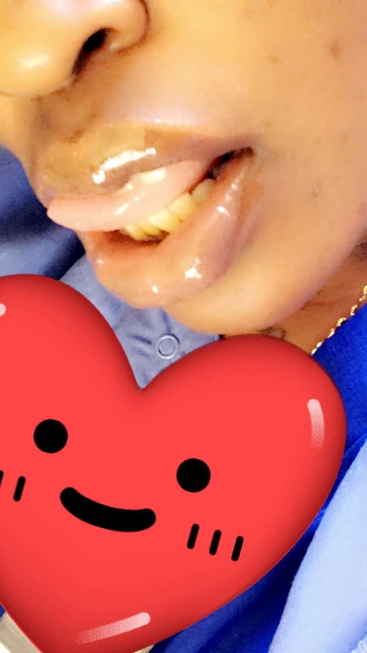 Lips