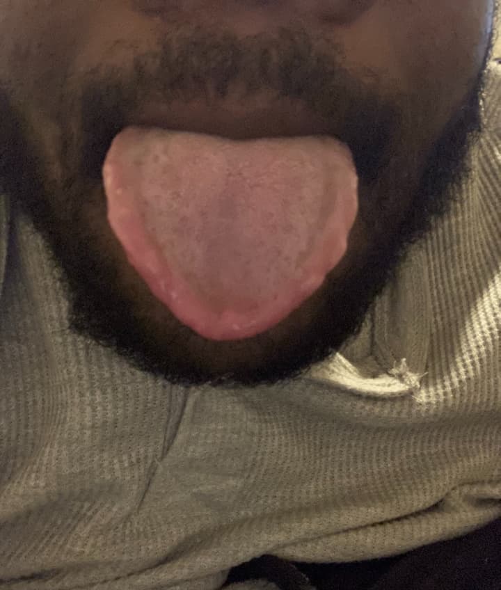 Choco